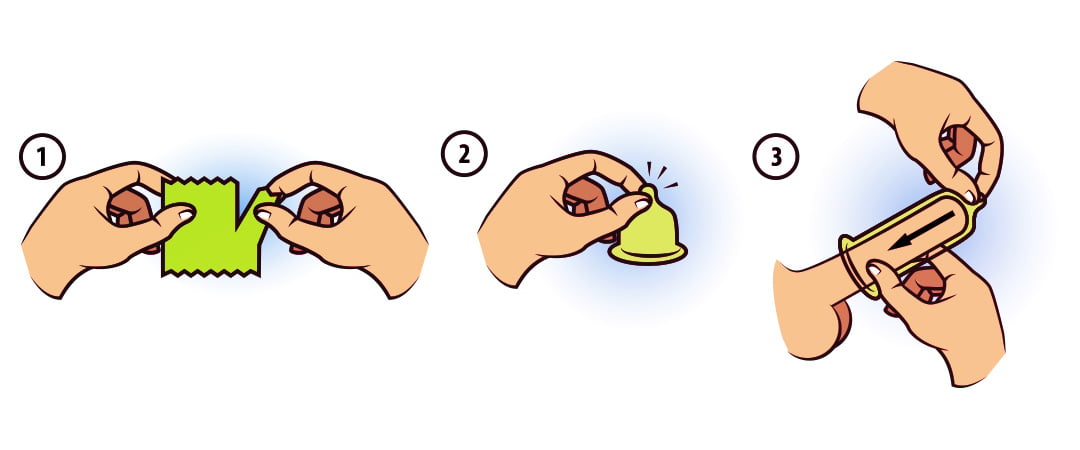 ilustracion-como-de-pone-un-condon-en-tres-pasos-usar-condones-1