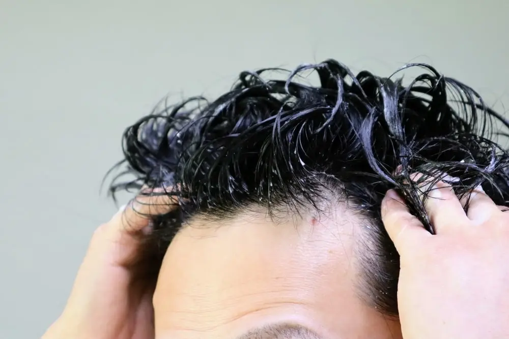 tratamiento para la caída de cabello